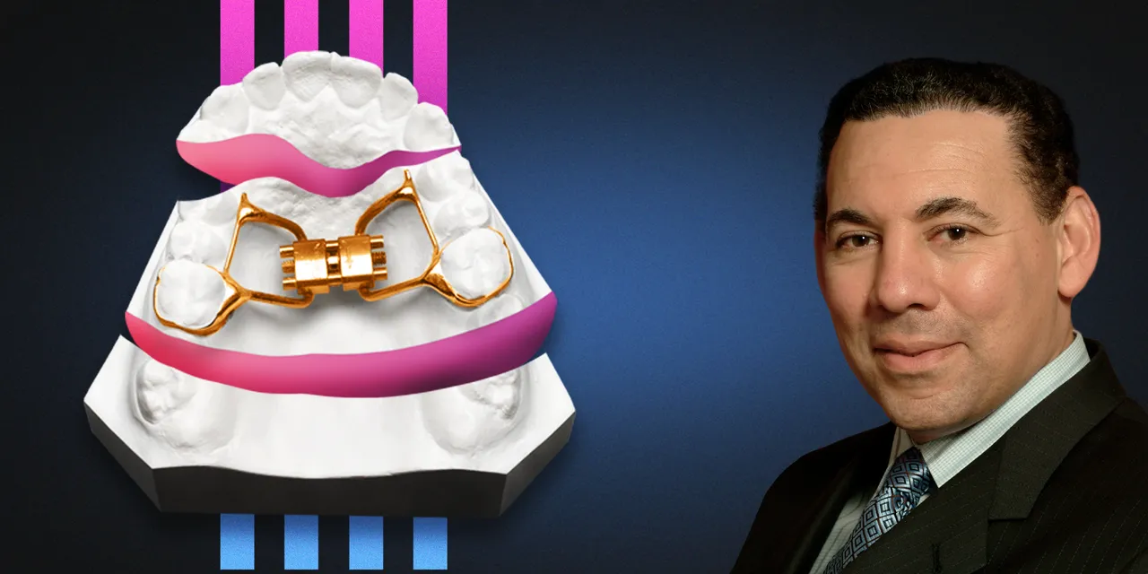 OHI-S Functional orthodontics. Autotransplantation. Result retention OHI-S Functional orthodontics. Autotransplantation. Result retention