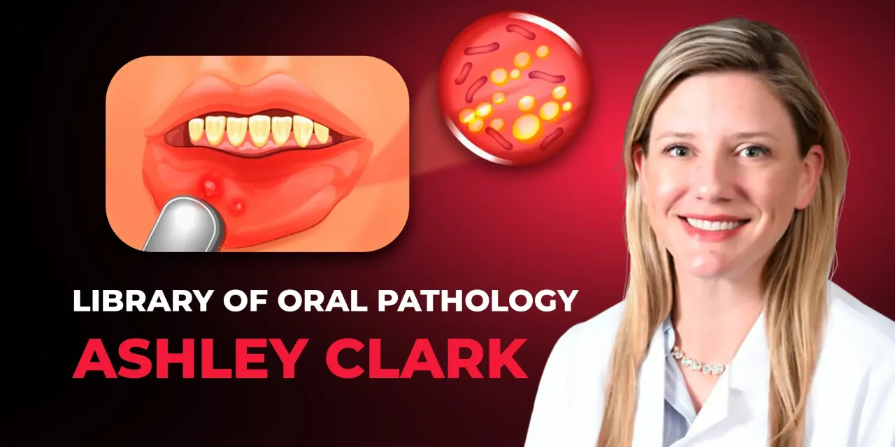 OHI-S Library of Oral Pathology Management of Precancerous and Cancerous Oral Lesions OHI-S Library of Oral Pathology Management of Precancerous and Cancerous Oral Lesions