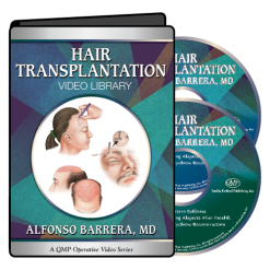 QMP Hair Transplantation 2017