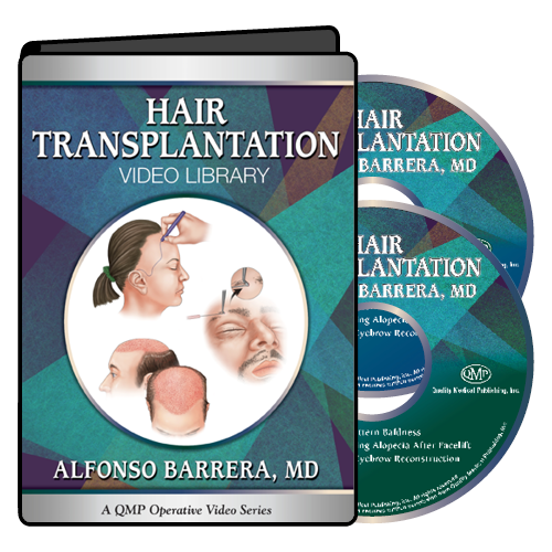 QMP Hair Transplantation 2017 QMP Hair Transplantation 2017