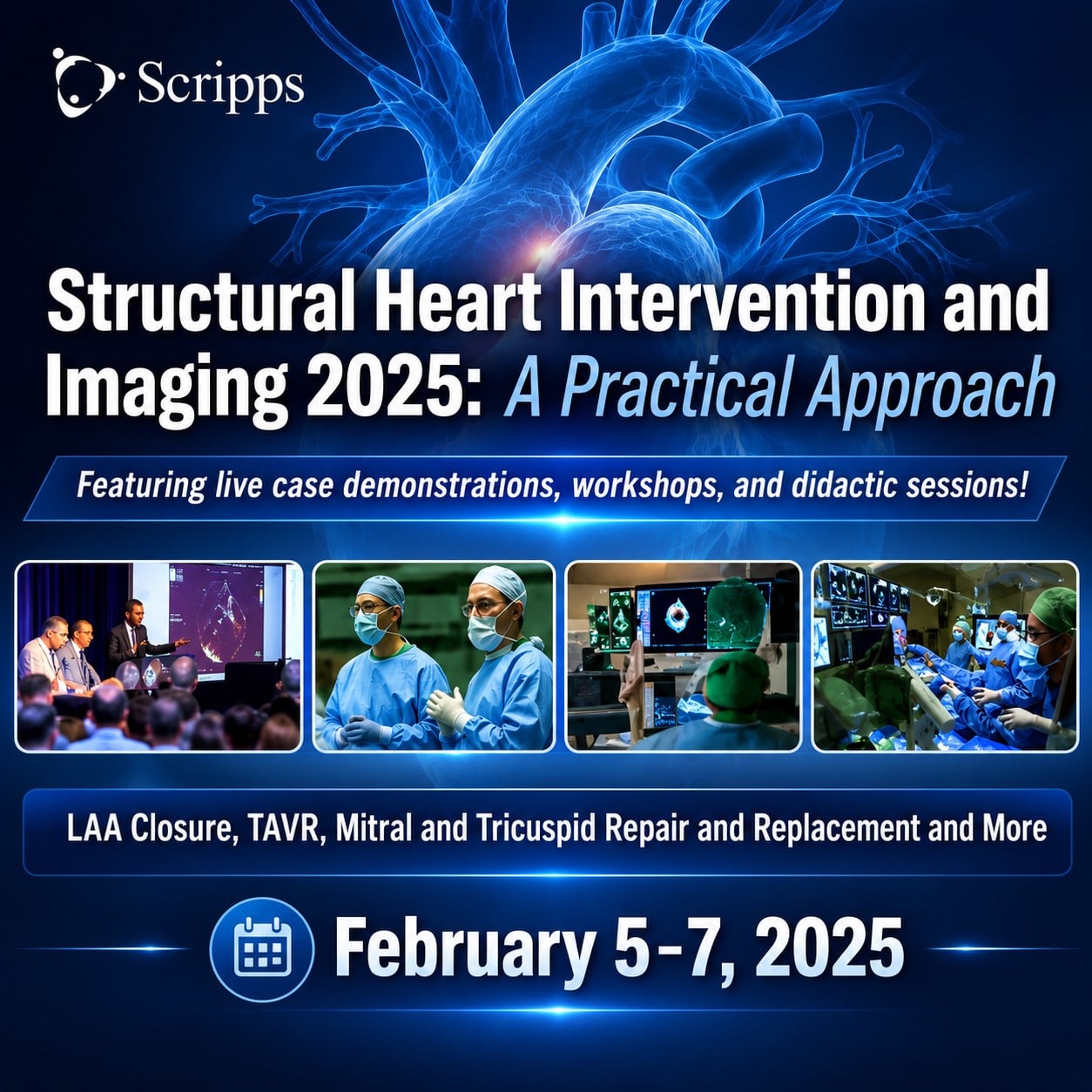 Scripps 14th Annual Structural Heart Intervention and Imaging 2025 Scripps 14th Annual Structural Heart Intervention and Imaging 2025