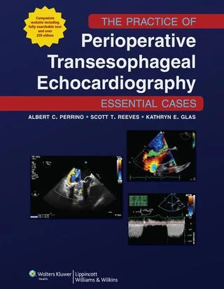 The Practice of Perioperative Transesophageal Echocardiography: Essential Cases (EPUB) The Practice of Perioperative Transesophageal Echocardiography Essential Cases (EPUB)