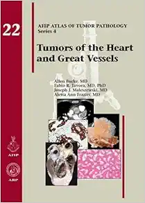 Tumors of the Heart and Great Vessels (AFIP Atlas of Tumor Pathology, Series 4, 22) (Original PDF from Publisher) Tumors of the Heart and Great Vessels (AFIP Atlas of Tumor Pathology, Series 4, 22) (Original PDF from Publisher)