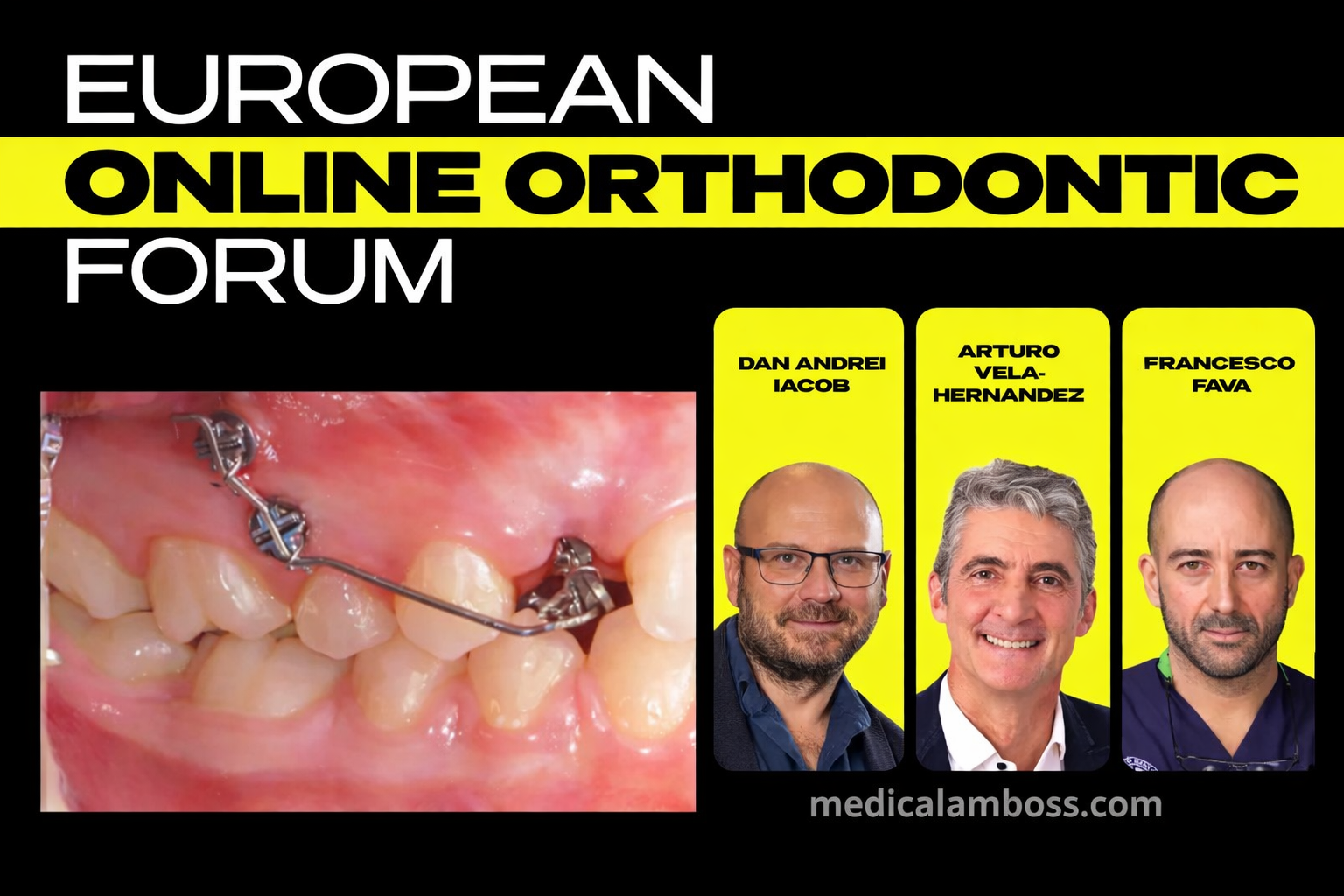 OHI-S European Online Orthodontic Forum. Advanced Protocols and Innovative Orthodontic Practices OHI-S European Online Orthodontic Forum. Advanced Protocols and Innovative Orthodontic Practices