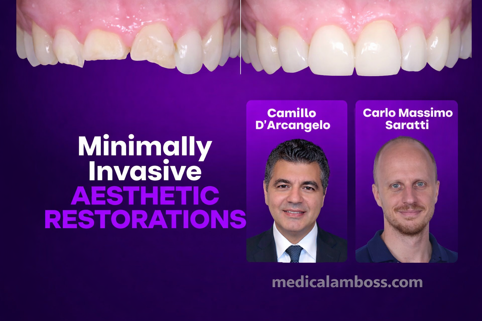 OHI-S Minimally Invasive Aesthetic Restorations Additive, Digital, and Fully Functional Rehabilitation OHI-S Minimally Invasive Aesthetic Restorations Additive, Digital, and Fully Functional Rehabilitation