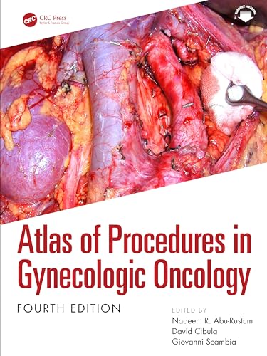 Atlas of Procedures in Gynecologic Oncology, 4th edition (Original PDF from Publisher) Atlas of Procedures in Gynecologic Oncology, 4th edition (Original PDF from Publisher)