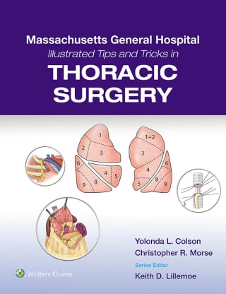 Massachusetts General Hospital Illustrated Tips and Tricks in Thoracic Surgery (EPUB) MGH Illustrated Tips and Tricks in Thoracic Surgery (EPUB)