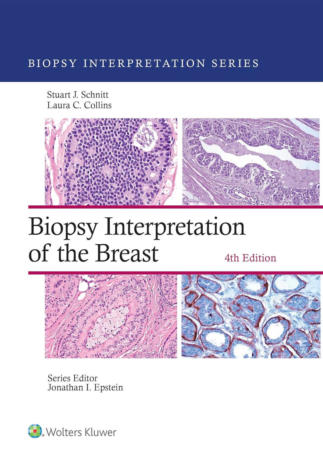 Biopsy Interpretation of the Breast (Biopsy Interpretation Series), 4th Edition (EPUB and pdf) Biopsy Interpretation of the Breast (Biopsy Interpretation Series), 4th Edition (EPUB and pdf)