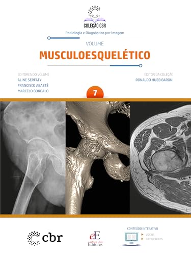 Coleção CBR Volume 7 – Musculoesquelético (Portuguese Edition) (EPUB) Coleção CBR Volume 7 – Musculoesquelético (Portuguese Edition) (EPUB)