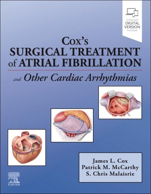 Cox’s Surgical Treatment of Atrial Fibrillation (EPUB) Cox’s Surgical Treatment of Atrial Fibrillation (EPUB)