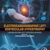 Electrocardiographic Left Ventricular Hypertrophy: Looking Beyond Left Ventricular Mass (True PDF from Publisher) Electrocardiographic Left Ventricular Hypertrophy