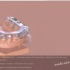 OHI-S The occlusal Plane System – predictable approach when dealing with complex and functional cases in everyday practice OHI-S The occlusal Plane System – predictable approach when dealing with complex and functional cases in everyday practice