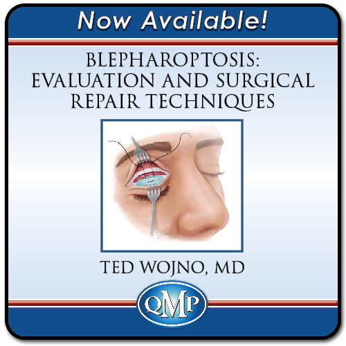 QMP Blepharoptosis Evaluation and Surgical Repair Techniques 2022 QMP Blepharoptosis Evaluation and Surgical Repair Techniques 2022
