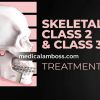 OHI-S Skeletal Class 2 & Class 3 treatment team approach orthodontist-surgeon OHI-S Skeletal Class 2 & Class 3 treatment team approach orthodontist-surgeon