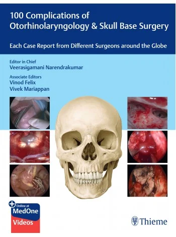 100 Complications of Otorhinolaryngology & Skull Base Surgery (Original PDF from Publisher+Videos) 100 Complications of Otorhinolaryngology & Skull Base Surgery (Original PDF from Publisher+Videos)