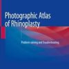 Photographic Atlas of Rhinoplasty book and videos Photographic Atlas of Rhinoplasty book and videos