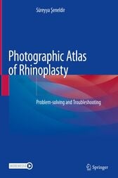 Photographic Atlas of Rhinoplasty book and videos Photographic Atlas of Rhinoplasty book and videos