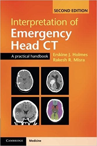 Interpretation of Emergency Head CT: A Practical Handbook, 2e (ORIGINAL PDF from Publisher) Interpretation of Emergency Head CT: A Practical Handbook, 2e (ORIGINAL PDF from Publisher)