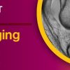 Knee Imaging Essentials 2023 WEBCAST SERIES Knee Imaging Essentials 2023 WEBCAST SERIES