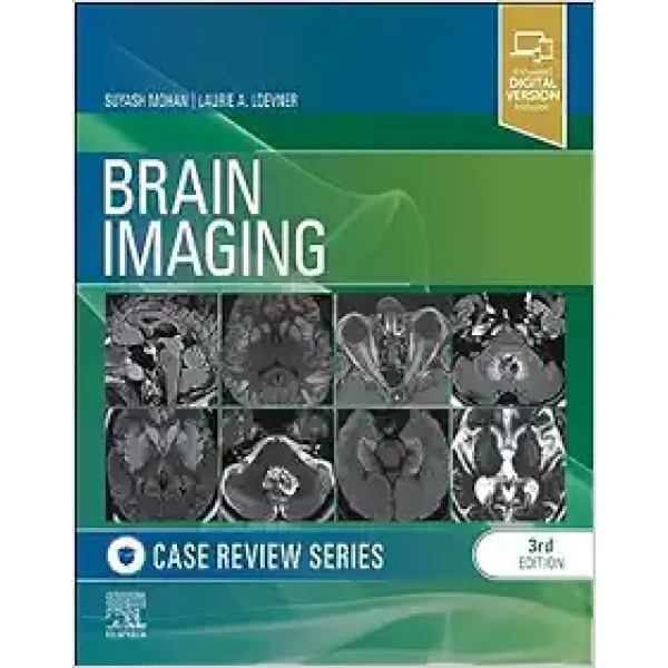 Brain Imaging: Case Review Series, 3rd Edition (Original PDF From Publisher) Brain Imaging: Case Review Series, 3rd Edition (Original PDF From Publisher)