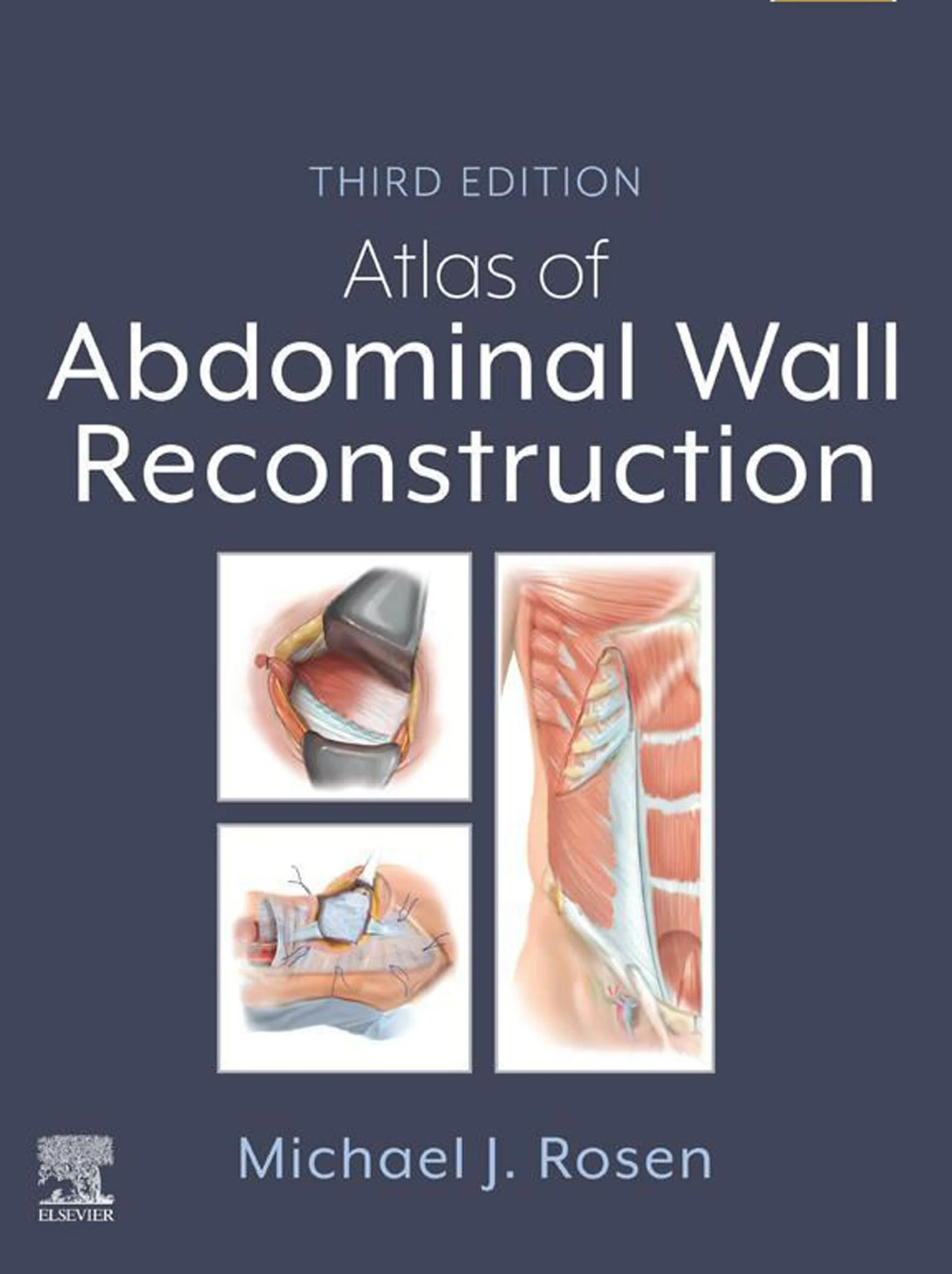 Atlas of Abdominal Wall Reconstruction, 3rd Edition (Original PDF from Publisher) Atlas of Abdominal Wall Reconstruction, 3rd Edition (Original PDF from Publisher)