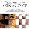 Treatments for Skin of Color Treatments for Skin of Color