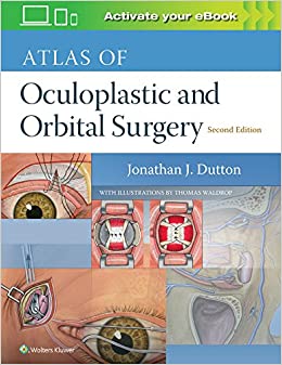 Atlas of Oculoplastic and Orbital Surgery, 2nd edition (Original PDF from Publisher) Atlas of Oculoplastic and Orbital Surgery, 2nd edition (Original PDF from Publisher)