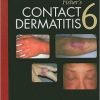 Fisher’s Contact Dermatitis, 6th Edition (Original PDF from Publisher) Fisher’s Contact Dermatitis, 6th Edition (Original PDF from Publisher)