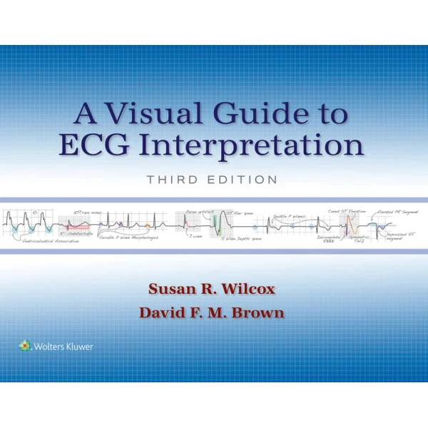 A Visual Guide To ECG Interpretation, 3rd Edition (EPUB) A Visual Guide To ECG Interpretation, 3rd Edition (EPUB)