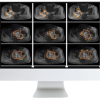 ARRS Crossroads of Computational Science and Musculoskeletal Imaging: Where Machine Magic Can Aid Radiologists 2021 (CME VIDEOS) ARRS Crossroads of Computational Science and Musculoskeletal Imaging: Where Machine Magic Can Aid Radiologists 2021 (CME VIDEOS)