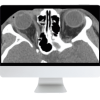 ARRS Imaging Victims of Violence: Fists, Stabs, Bullets, and Blasts 2021 (CME VIDEOS) ARRS Imaging Victims of Violence: Fists, Stabs, Bullets, and Blasts 2021 (CME VIDEOS)