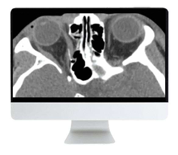 ARRS Imaging Victims of Violence: Fists, Stabs, Bullets, and Blasts 2021 (CME VIDEOS) ARRS Imaging Victims of Violence: Fists, Stabs, Bullets, and Blasts 2021 (CME VIDEOS)