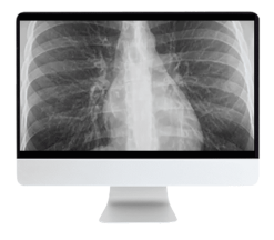 ARRS Cranial Nerve Imaging: From the Least to the Last 2022 ( Videos )
