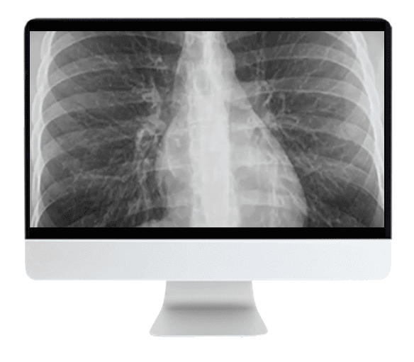 ARRS Cranial Nerve Imaging: From the Least to the Last 2022 ( Videos ) ARRS Cranial Nerve Imaging: From the Least to the Last 2022 ( Videos )