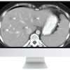 ARRS SAR Disease-Focused Panels: Cancer Imaging and Reporting Guidelines 2021 ( VIDEOS)
