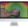 ARRS Understanding MR Safety Through AI Software Simulation 2021 ( VIDEOS) ARRS Understanding MR Safety Through AI Software Simulation 2021 ( VIDEOS)