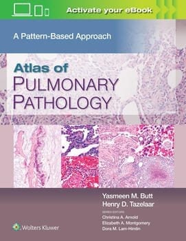 Atlas of Pulmonary Pathology Atlas of Pulmonary Pathology