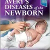 Avery’s Diseases of the Newborn, 11th edition (True PDF)