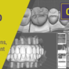 BASIC EXOCAD: Models, Crowns, Splints, Implant Crowns, AOX, & More BASIC EXOCAD: Models, Crowns, Splints, Implant Crowns, AOX, & More