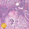 Breast Pathology 2023 (CME VIDEOS) Breast Pathology 2023 (CME VIDEOS)