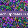 Cedars Sinai Research Updates in Lymphoma 2025 Cedars Sinai Research Updates in Lymphoma 2025