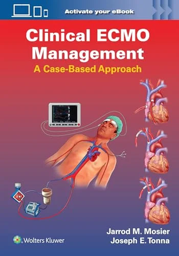 Clinical ECMO Management: A Case-Based Approach (EPUB) Clinical ECMO Management A Case-Based Approach (EPUB)