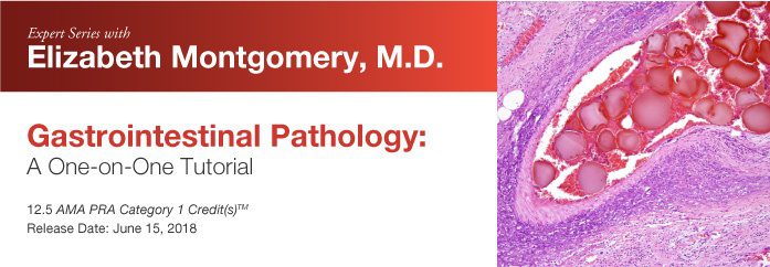DocmedED 2018 Expert Series with Elizabeth Montgomery, M.D. Gastrointestinal Pathology A One-On-One Tutorial DocmedED 2018 Expert Series with Elizabeth Montgomery, M.D. Gastrointestinal Pathology A One-On-One Tutorial