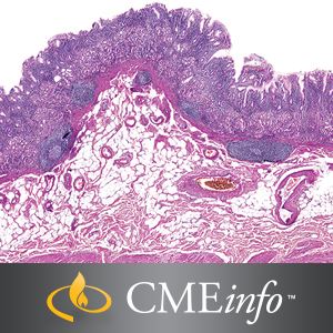 Gastrointestinal Pathology – Masters of Pathology Series 2018 Gastrointestinal Pathology – Masters of Pathology Series 2018