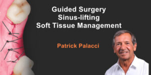 Guided Surgery, Sinus-Lifting, Soft Tissue Management Guided Surgery, Sinus-Lifting, Soft Tissue Management