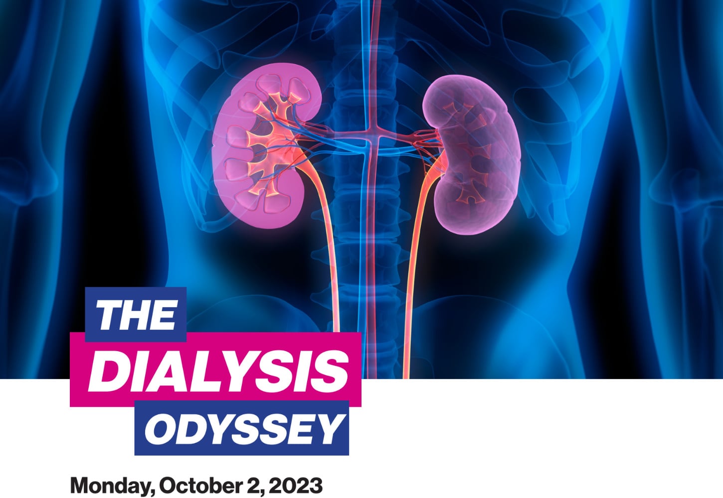 Icahn School of Medicine The Dialysis Odyssey 2023 Icahn School of Medicine The Dialysis Odyssey 2023