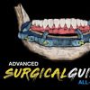 Implant Ninja, Advanced Surgical Guides – All on X – Dental Videos Implant Ninja, Advanced Surgical Guides – All on X – Dental Videos