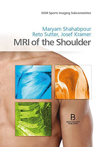 MRI of the Shoulder (Original PDF from Publisher) MRI of the Shoulder (Original PDF from Publisher)