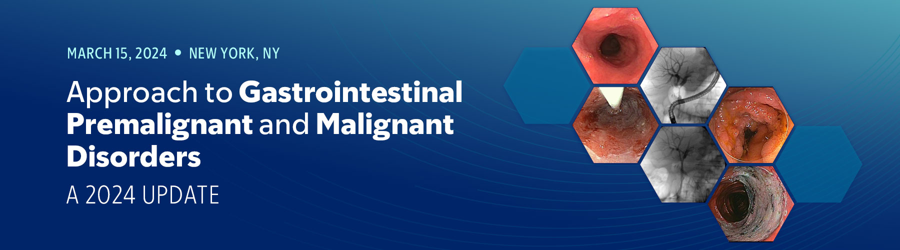 Approach to Gastrointestinal Premalignant and Malignant Disorders 2024 Approach to Gastrointestinal Premalignant and Malignant Disorders 2024