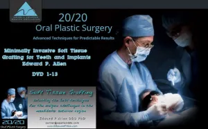 Minimally Invasive Soft Tissue Grafting for Teeth and Implants Minimally Invasive Soft Tissue Grafting for Teeth and Implants